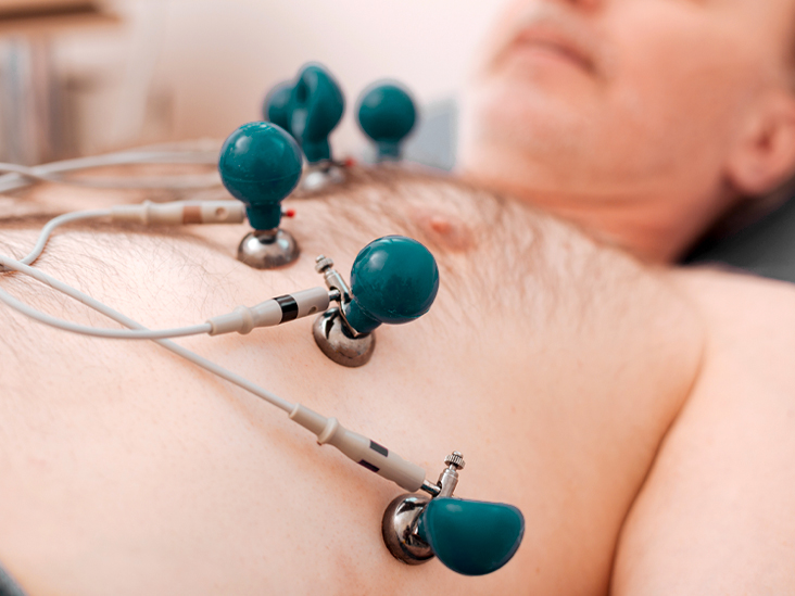 Elektrokardiographischer Nachweis eines früheren Herzinfarkts