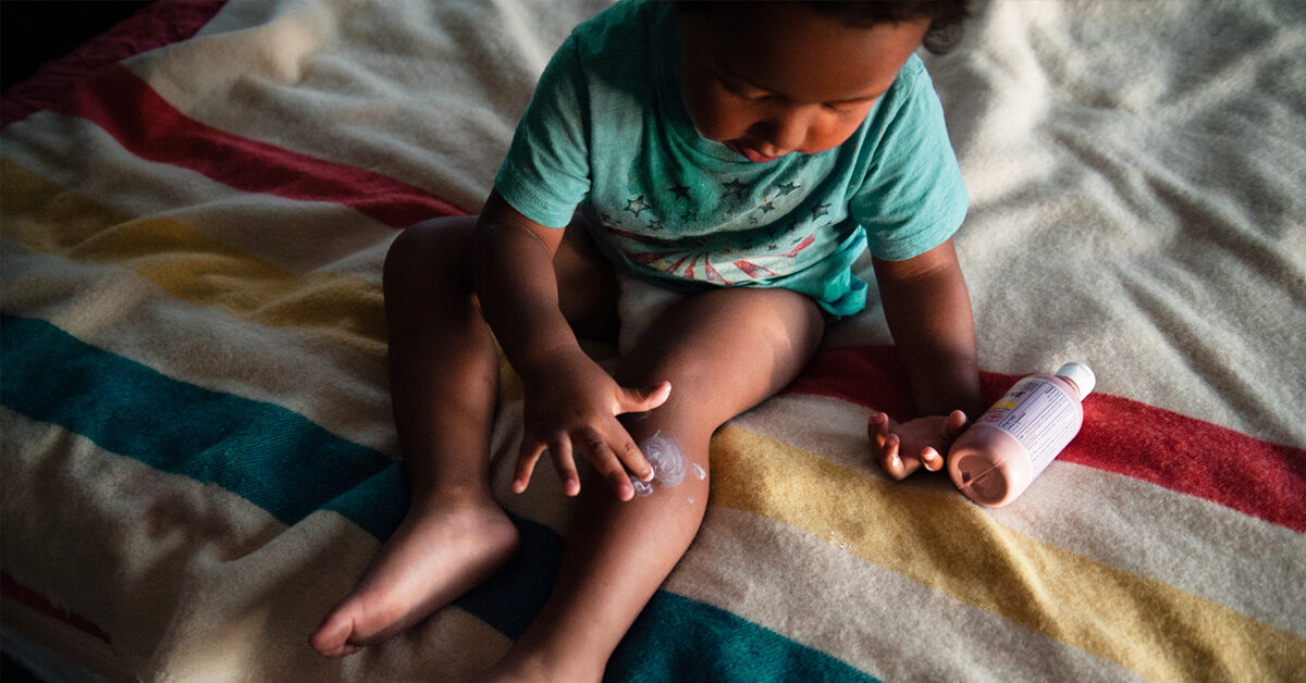 Spinnenbisse bei Babys: Symptome, Behandlung, was jetzt zu tun ist