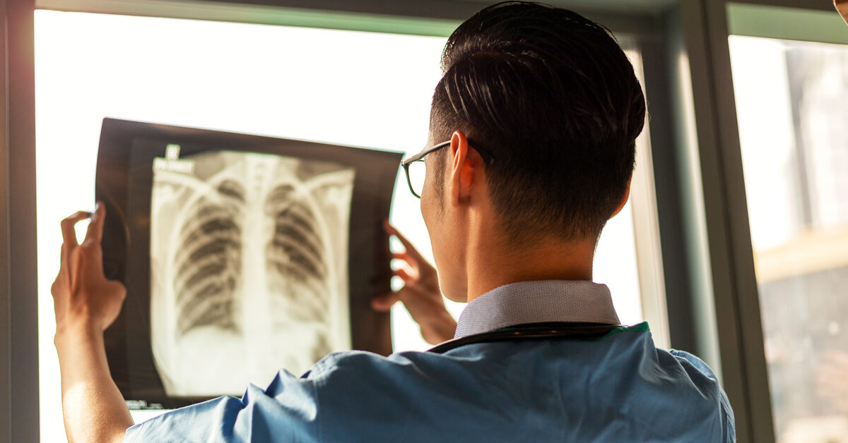 Lungenadenokarzinom: Symptome, Ursachen, Risikofaktoren und Behandlung