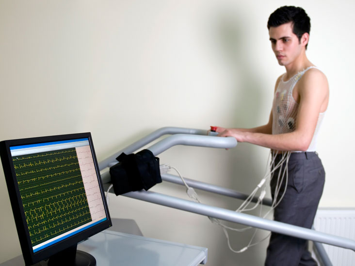 Stresstest: Zweck, Vorgehensweise und Risiken