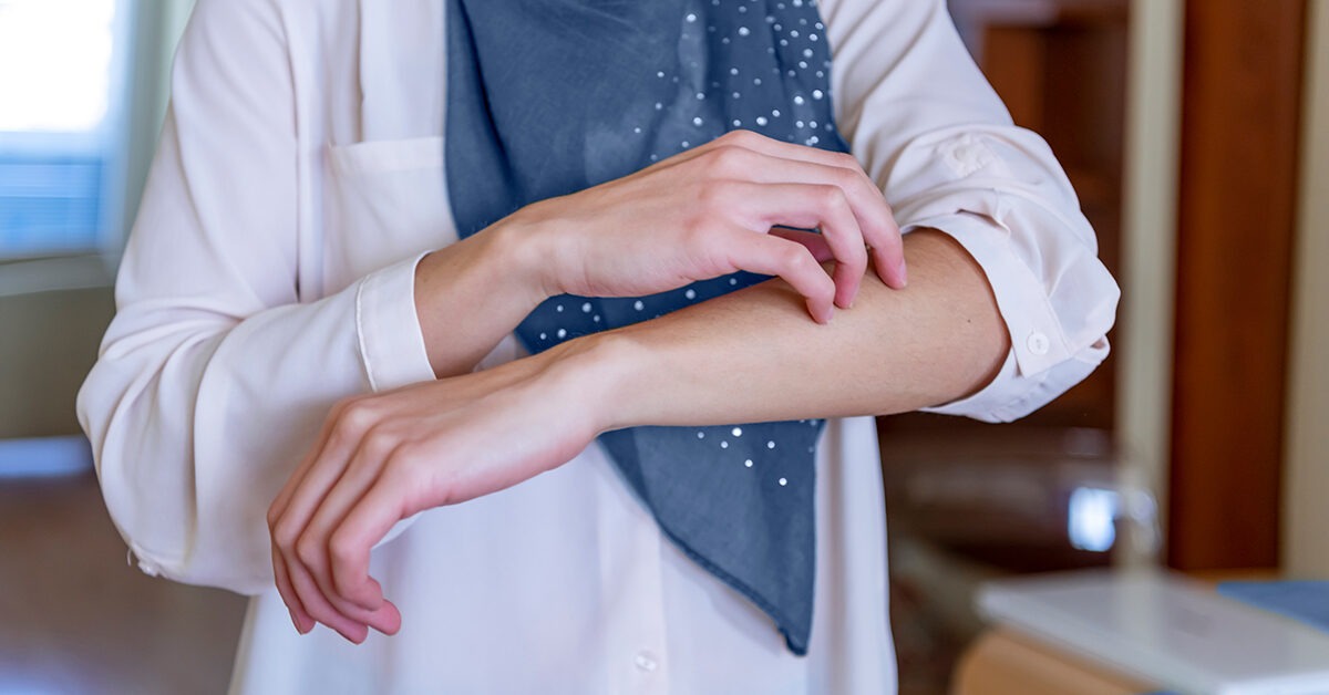 Angst und Juckreiz: Warum es passiert und was zu tun ist