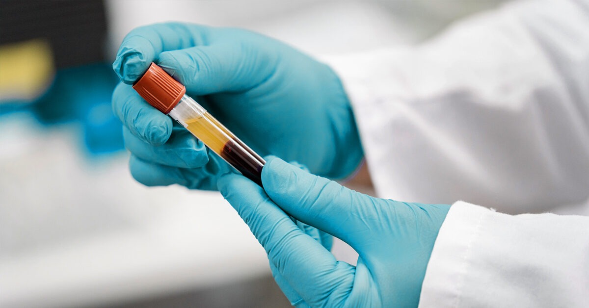 Eierstockkrebs-Bluttest: Wann und warum er verwendet wird