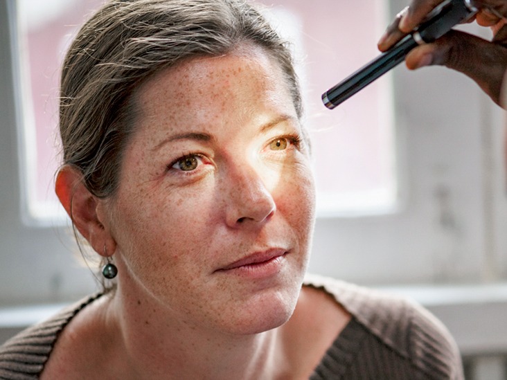 Können trockene Augen geheilt werden?  Ihre FAQs