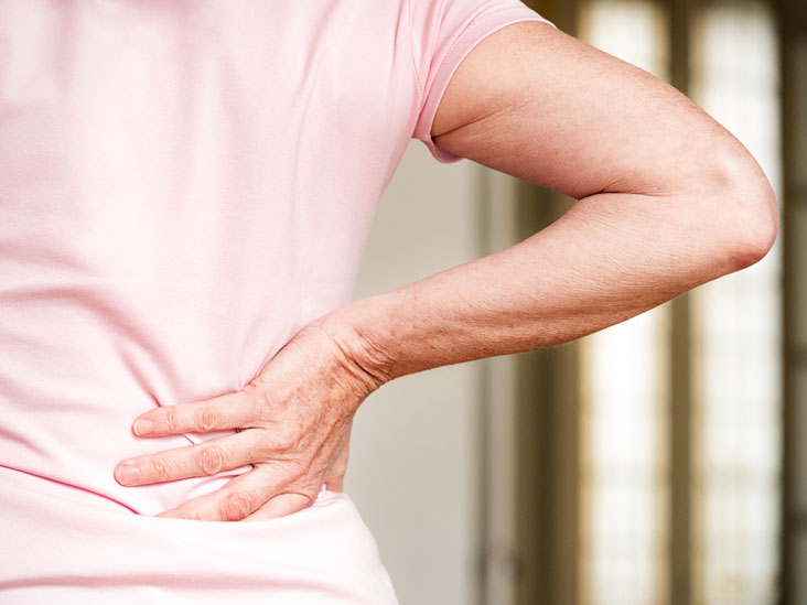 17 Auswirkungen der ankylosierenden Spondylitis auf den Körper