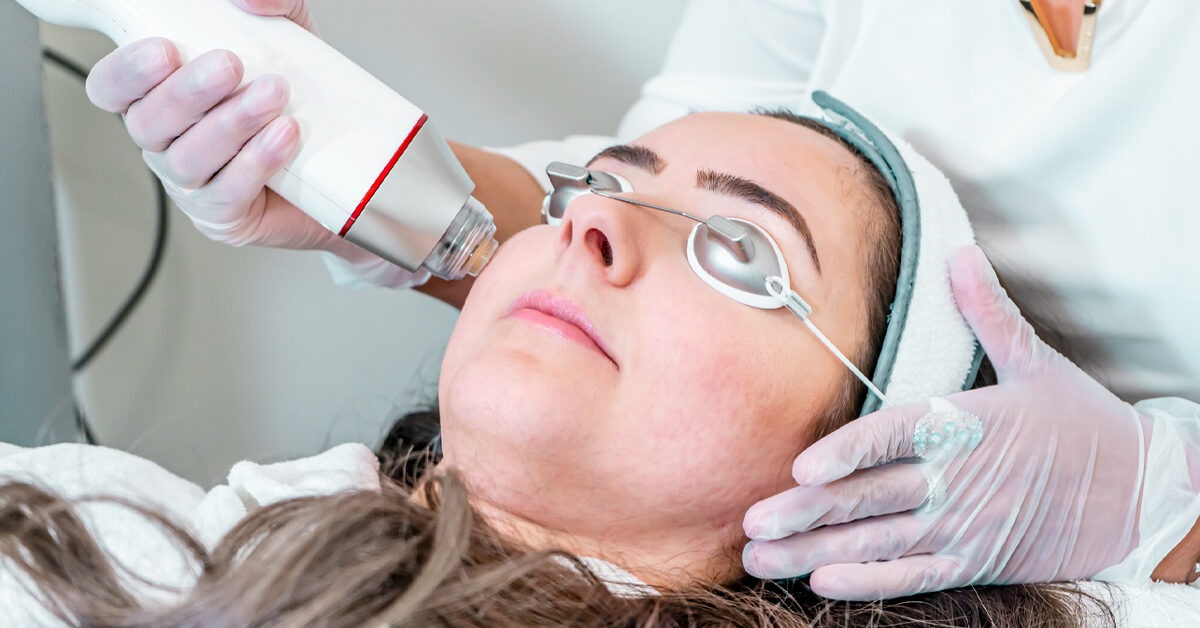 Infini Microneedling Vorteile, Nebenwirkungen, Anwendungen, Bilder