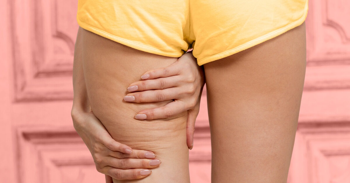 Oberschenkel-Gap-Chirurgie: Verfahrensoptionen, Vorteile, Risiken, Kosten