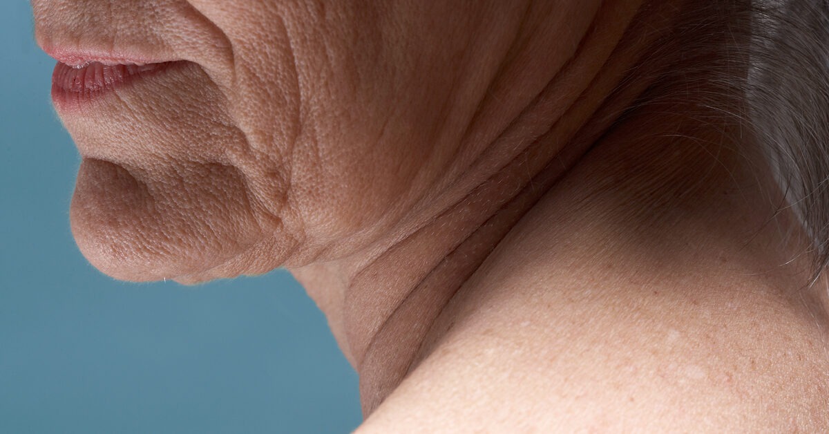 Knochensporne im Nacken: Symptome, Ursachen und Behandlung