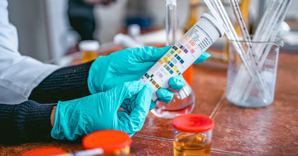 Was Sie über den Urin-pH-Wert-Test wissen müssen